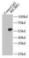 Interferon Regulatory Factor 2 Binding Protein 2 antibody, FNab04388, FineTest, Immunoprecipitation image 