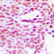 H1 Histone Family Member 0 antibody, LS-C352297, Lifespan Biosciences, Immunohistochemistry paraffin image 