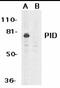 Metastasis Associated 1 Family Member 2 antibody, MBS395660, MyBioSource, Western Blot image 