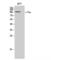 Colony Stimulating Factor 1 Receptor antibody, LS-C382682, Lifespan Biosciences, Western Blot image 