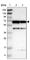 Carnitine O-Octanoyltransferase antibody, HPA019365, Atlas Antibodies, Western Blot image 