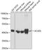 Acyl-CoA Dehydrogenase Long Chain antibody, 14-568, ProSci, Western Blot image 