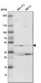 Farnesyl-Diphosphate Farnesyltransferase 1 antibody, HPA008874, Atlas Antibodies, Western Blot image 