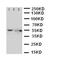 Solute carrier family 2, facilitated glucose transporter member 5 antibody, orb76250, Biorbyt, Western Blot image 
