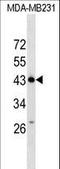 Zinc Finger Protein 550 antibody, LS-C157466, Lifespan Biosciences, Western Blot image 