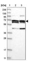 WD Repeat Domain 36 antibody, NBP1-83362, Novus Biologicals, Western Blot image 