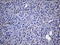 Caudal Type Homeobox 2 antibody, LS-C797065, Lifespan Biosciences, Immunohistochemistry paraffin image 