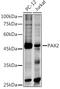 Paired Box 2 antibody, GTX54602, GeneTex, Western Blot image 