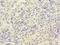 Hexokinase 3 antibody, LS-C675866, Lifespan Biosciences, Immunohistochemistry paraffin image 