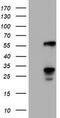 T-Complex 11 Like 2 antibody, M18041-1, Boster Biological Technology, Western Blot image 