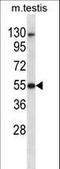 Death Associated Protein Kinase 3 antibody, LS-B11575, Lifespan Biosciences, Western Blot image 