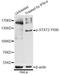 Signal Transducer And Activator Of Transcription 2 antibody, MBS128413, MyBioSource, Western Blot image 