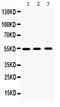 Matrix Metallopeptidase 10 antibody, PB9670, Boster Biological Technology, Western Blot image 
