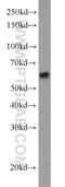 Thromboxane A Synthase 1 antibody, 11321-1-AP, Proteintech Group, Western Blot image 