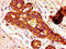 FASN antibody, LS-C370773, Lifespan Biosciences, Immunohistochemistry paraffin image 