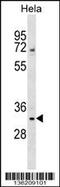 WD Repeat Domain 4 antibody, 59-281, ProSci, Western Blot image 