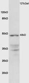 Testin LIM Domain Protein antibody, orb100540, Biorbyt, Western Blot image 