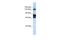 Family With Sequence Similarity 83 Member B antibody, A09865, Boster Biological Technology, Western Blot image 