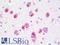Proteasome Subunit Alpha 7 antibody, LS-B9946, Lifespan Biosciences, Immunohistochemistry paraffin image 