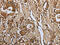 Peroxisome Proliferator Activated Receptor Alpha antibody, CSB-PA945095, Cusabio, Immunohistochemistry paraffin image 
