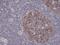 Aurora Kinase B antibody, M00762-4, Boster Biological Technology, Immunohistochemistry paraffin image 