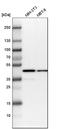 Isocitrate Dehydrogenase (NADP(+)) 1, Cytosolic antibody, HPA035248, Atlas Antibodies, Western Blot image 