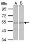 Cytoplasmic Polyadenylation Element Binding Protein 1 antibody, GTX104682, GeneTex, Western Blot image 
