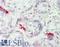 Integrin Subunit Beta 3 antibody, LS-B12431, Lifespan Biosciences, Immunohistochemistry paraffin image 