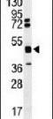 HNRPK antibody, PA5-12481, Invitrogen Antibodies, Western Blot image 