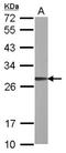 ADP Ribosylation Factor Like GTPase 1 antibody, NBP2-15461, Novus Biologicals, Western Blot image 