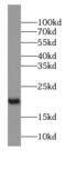 Putative protein FAM30A antibody, FNab04527, FineTest, Western Blot image 