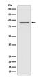 Signal Transducer And Activator Of Transcription 1 antibody, M00036, Boster Biological Technology, Western Blot image 