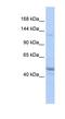 KIAA0319 Like antibody, NBP1-59238, Novus Biologicals, Western Blot image 