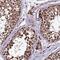Zinc Finger Protein 766 antibody, PA5-60856, Invitrogen Antibodies, Immunohistochemistry frozen image 