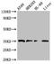 Palmitoyl-Protein Thioesterase 1 antibody, LS-C679135, Lifespan Biosciences, Western Blot image 