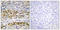 Nuclear Factor Kappa B Subunit 1 antibody, LS-C199317, Lifespan Biosciences, Immunohistochemistry paraffin image 