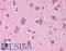 COP9 Signalosome Subunit 8 antibody, LS-B4592, Lifespan Biosciences, Immunohistochemistry paraffin image 