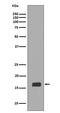 Synuclein Alpha antibody, M00215, Boster Biological Technology, Western Blot image 