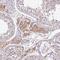 Calcium Binding Protein 39 Like antibody, NBP2-32039, Novus Biologicals, Immunohistochemistry paraffin image 