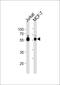 Zinc Finger And SCAN Domain Containing 32 antibody, PA5-35253, Invitrogen Antibodies, Western Blot image 