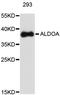 Aldolase, Fructose-Bisphosphate A antibody, abx126825, Abbexa, Western Blot image 