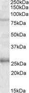 GPRIN Family Member 3 antibody, EB10209, Everest Biotech, Western Blot image 
