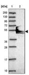 Pyruvate Dehydrogenase E1 Alpha 2 Subunit antibody, NBP2-33922, Novus Biologicals, Western Blot image 