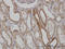 Mitofusin 2 antibody, LS-C133609, Lifespan Biosciences, Immunohistochemistry paraffin image 