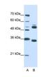 WD Repeat Domain 6 antibody, orb324951, Biorbyt, Western Blot image 
