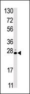 Serine/Threonine Kinase 19 antibody, 62-715, ProSci, Western Blot image 