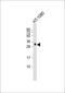 Growth Differentiation Factor 15 antibody, M01583, Boster Biological Technology, Western Blot image 