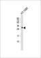 MIC-1 antibody, M01583, Boster Biological Technology, Western Blot image 