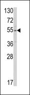 Solute Carrier Family 38 Member 3 antibody, LS-B12358, Lifespan Biosciences, Western Blot image 