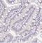 Ceramide-1-Phosphate Transfer Protein antibody, NBP2-30491, Novus Biologicals, Immunohistochemistry paraffin image 